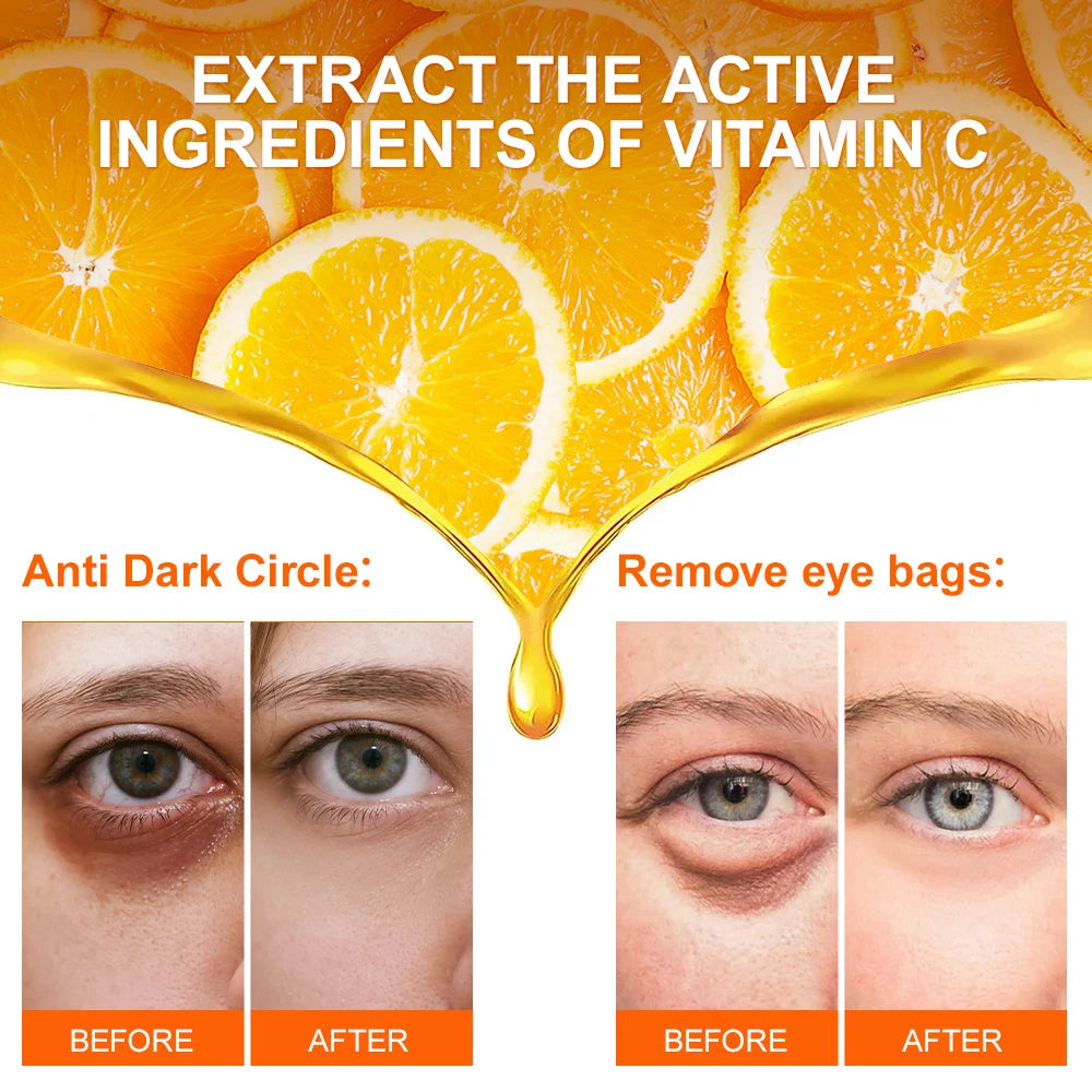 Anti Dark Circle Eye Cream - VC Whitening & Firming